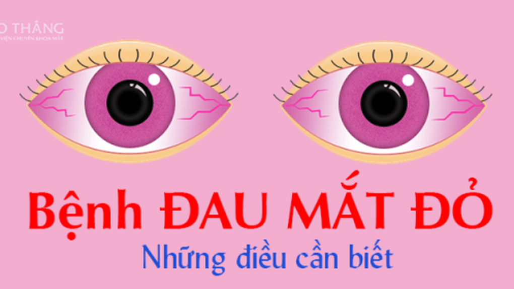 Tuyên truyền phòng chống bệnh đau mắt đỏ