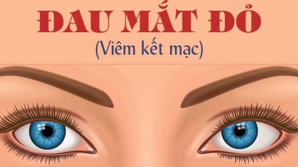 Tuyên truyền về bệnh đau mắt đỏ