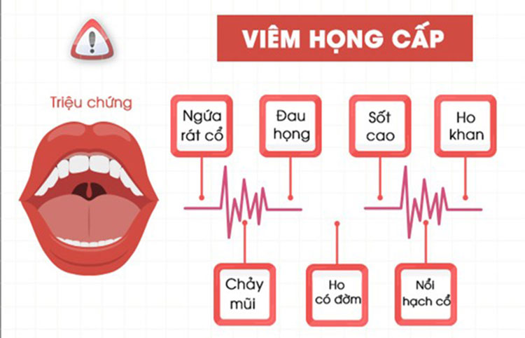 Viêm họng cấp: nguyên nhân, triệu chứng và cách điều trị tại nhà hiệu quả - Website chính thức của Omron tại Việt Nam